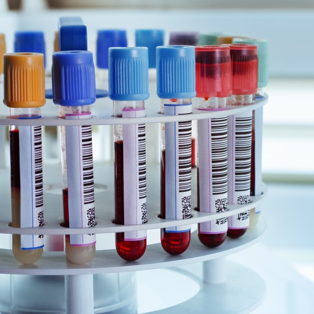stock blood samples